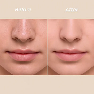 Peel Shot Ampoule (Extra 65% Off 🎉)