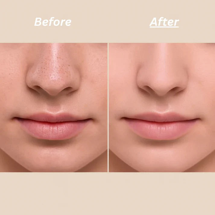 Dr Melaxin™ Peel Shot Ampoule (Extra 55% Off 🎉)