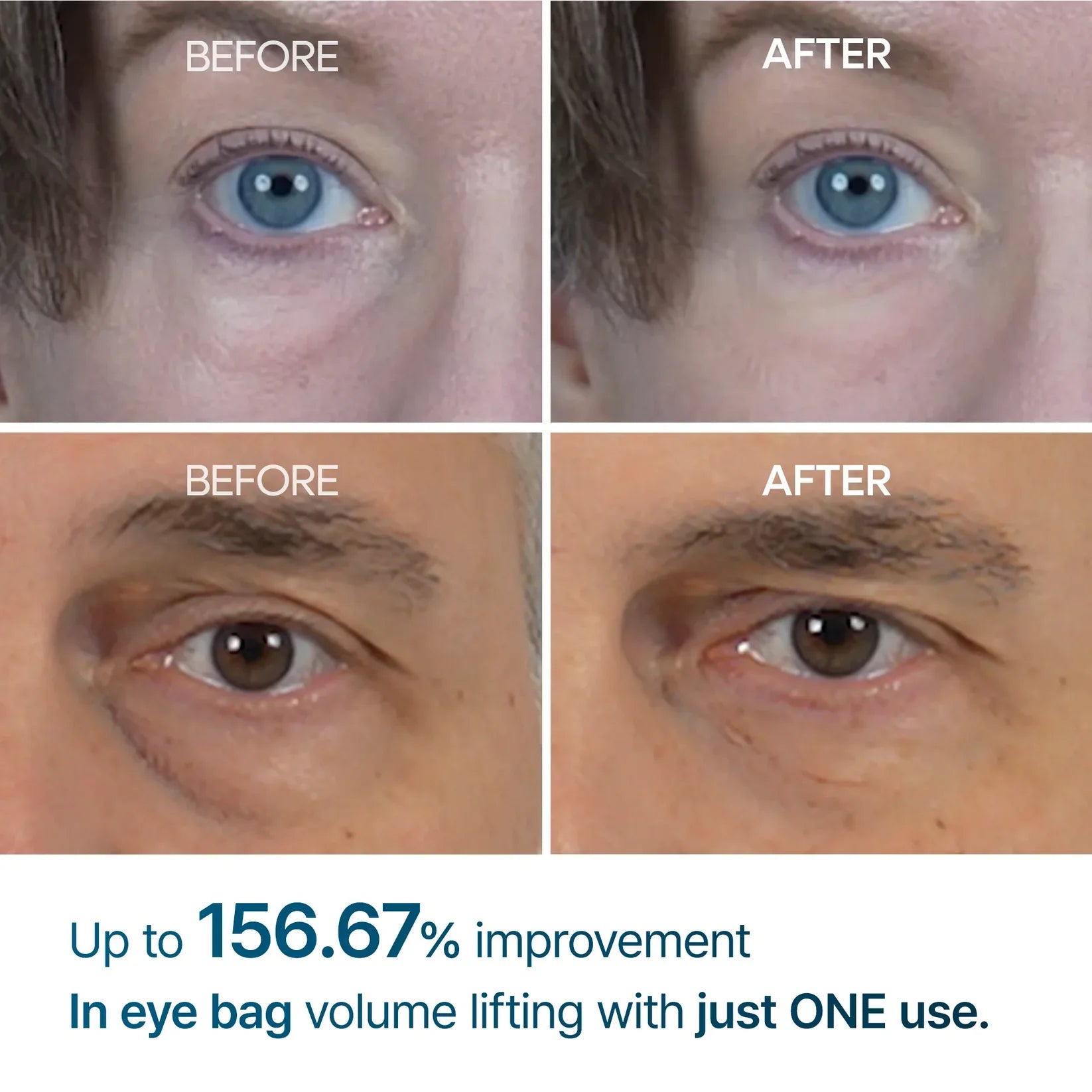 Dr Melaxin™ Eyephalt eyebag cream